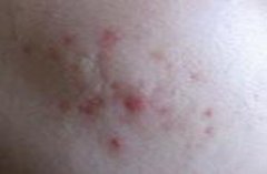 ��������Ƥ���ļ�ҽԺ��